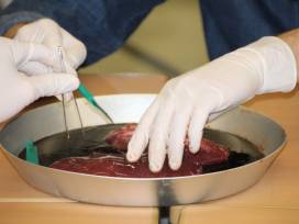 auf Herz und Nieren...